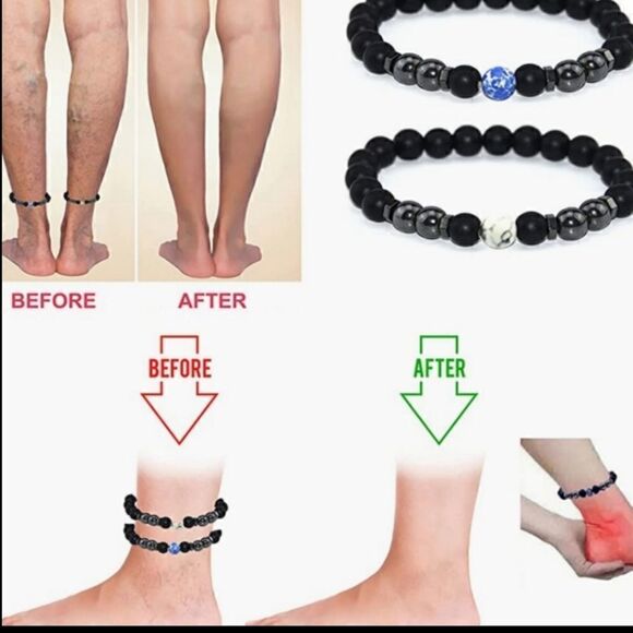 Anti swelling black obsidian stretch stone bracelet. - Picture 6 of 8